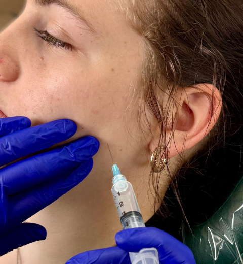 Trigger Point Injection - 3